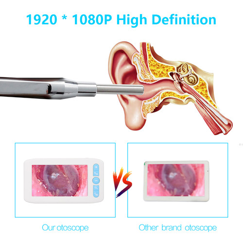 Digital Otoscope with 6 LEDs Lights 32G TFcard 3.9mmm 1080P High Definition Ear Scope Camera 4.3in IPS Screen Earwax Removal Tool and Specula for Adults and Kids
