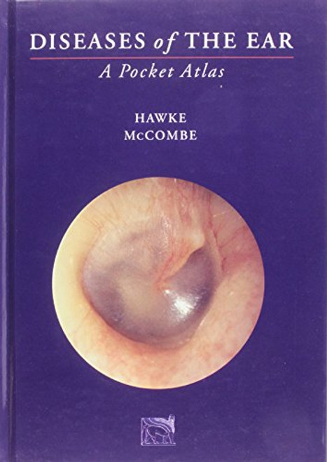 Diseases of the Ear : A Pocket Atlas
