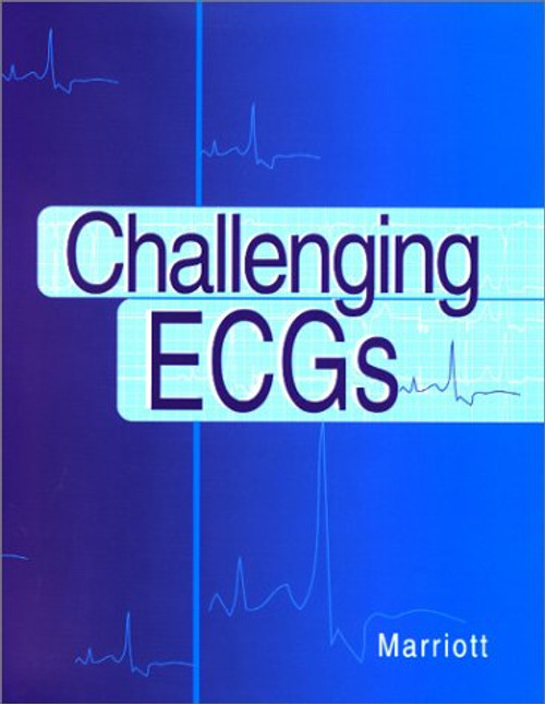 Challenging ECGs, 1e Challenging ECGs, 1e