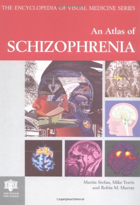 Atlas of Schizophrenia (Encyclopedia of Visual Medicine Series) Atlas of Schizophrenia (Encyclopedia of Visual Medicine Series)