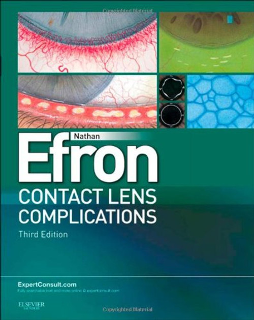 Contact Lens Complications: Expert Consult - Online and Print, 3e