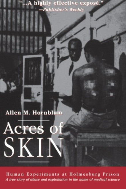 Acres of Skin: Human Experiments at Holmesburg Prison
