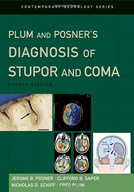 Plum and Posner's Diagnosis of Stupor and Coma (Contemporary Neurology Series)