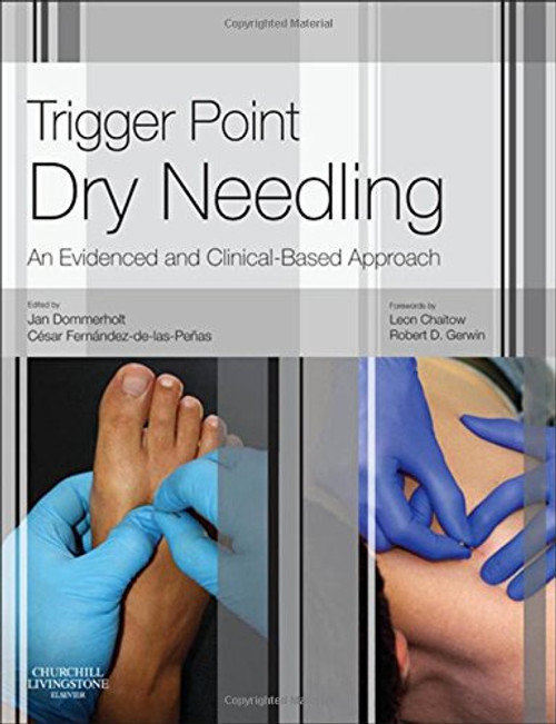 Trigger Point Dry Needling: An Evidence and Clinical-Based Approach, 1e