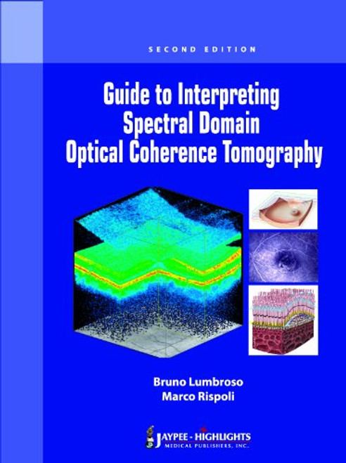Guide to Interpreting Spectral Domain Optical Coherence Tomography