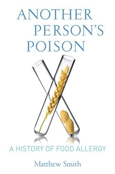 Another Persons Poison: A History of Food Allergy (Arts and Traditions of the Table: Perspectives on Culinary History)