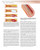 Coronary Stenting: A Companion to Topol's Textbook of Interventional Cardiology: Expert Consult - Online and Print, 1e (Expertconsult.com)