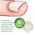 10PCS Ingrown Toenail Corrector Pad Foot Care Straightening Pad Toenail Patch Adhesive Toenail Correction Pedicure Toe Nail Treatment Patch Pad