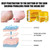 Cracked Skin Cream Banana Skin Care Cream Moisturizing Foot Care Cream for Dry Cracked Feet Heel