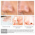 LANBENA Pore Treatment Serum Shrink Pores Blackhead Remover Acne Spots Hyaluronic Acid Face Essence