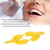 50Pcs/Set Disposable Fluoride Tray Dual Arch Trays  Dental Accessory ToolsM
