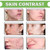 EELHOE Clear Acne Defense Gel Acne Blemish Removal Shrink Pores Skin Moisturing Hydrating Repair Gel