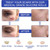 Self-adhesive Silicone Scar Patch 1.6x120 inches Transparent Invisible Scar Sheets Clear Scar Tape Scar Removal Sheets Soften and Smooth Scars Reduce Redness and Itching