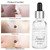 30g Moisturizing Snail Serum Snail Secretion Nourishing Skin Essence Face Anti Aging Essence
