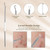 5PCS Stainless steel Acne Removal Kit Blackhead Remover Facial Pimple Comedone Needle