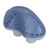 Electric Prevent Snoring Device Adjustable USB Rechargeable Portable Mini Snoring Problem Solution for Home Travel Blue