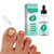 Nail Fungus Removal Liquid Natural Toenail Fungus Oil Nail Care