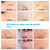 Adhesive Silicone Scar Patch Safety Mild Fade Scar Scar Reduction Therapy
