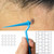 2 In 1 Skin Tag Remover Set Skin Tag Removal Kit with Rubber Bands Rings for Removing Small to Medium (2mm to 8mm) Sized Skin Tags Painlessly