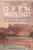 Open Wound: The Tragic Obsession of Dr. William Beaumont