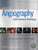 Abrams' Angiography: Interventional Radiology