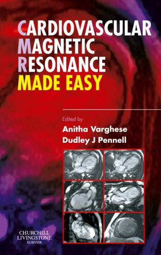 Cardiovascular Magnetic Resonance Made Easy, 1e