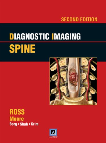 Diagnostic Imaging: Spine: Published by Amirsys