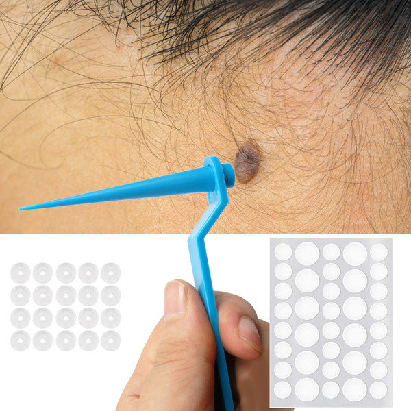 2 In 1 Skin Tag Remover Set Skin Tag Removal Kit with Rubber Bands Rings for Removing Small to Medium (2mm to 8mm) Sized Skin Tags Painlessly
