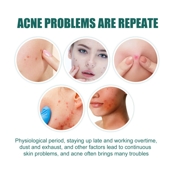 EELHOE 112 Patches Colorful Acne Patch Acne Removal Stickers Pimple Remover Tool Face Skin Care for Day Night Use