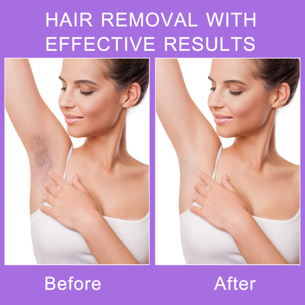 Laser Epilator Painless Hair Remover Bikini Trimmer USB Shaver Instant Depilation Tool For Face Arms Legs Beauty Health Care