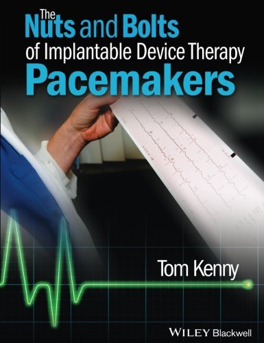 The Nuts and Bolts of Implantable Device Therapy: Pacemakers (The Nuts and Bolts Series)
