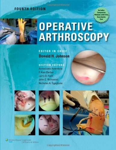 Operative Arthroscopy