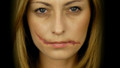 Rigid Collodion - Scarring Liquid