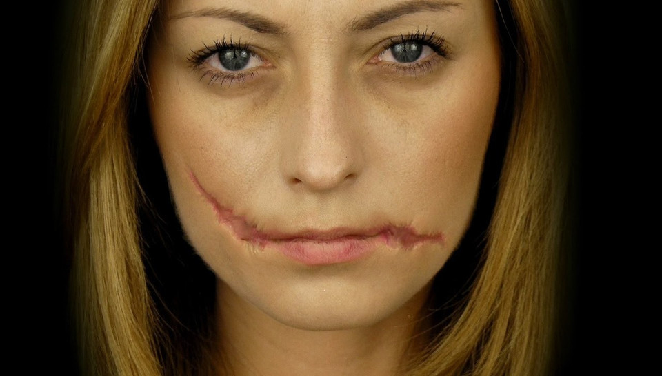 Rigid Collodion - Scarring Liquid