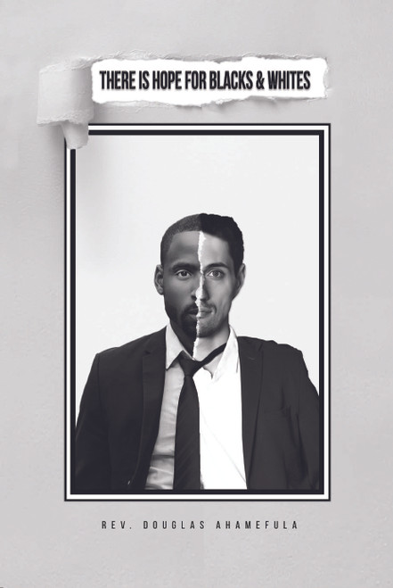 There Is Hope for Blacks & Whites - eBook