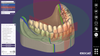 Exocad digital denture design