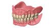 WTI digital denture