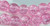 Bead, 50 Pink Crystal Crackle Glass 8mm Round Beads with 1-1.6mm Hole  *