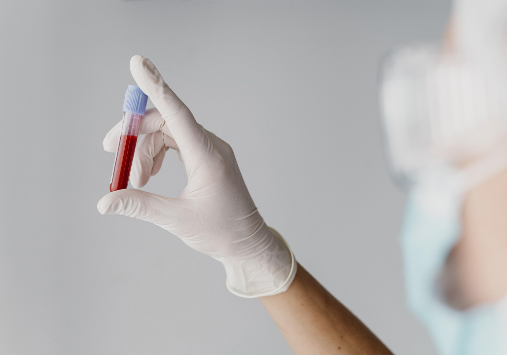 Análisis clínicos en Farmacia GA, en Madrid