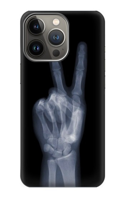 W3101 X-ray Peace Sign Fingers Hard Case and Leather Flip Case For iPhone 13 Pro