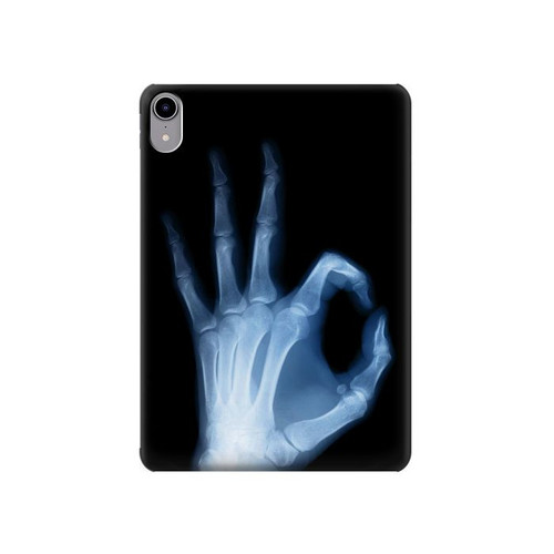 W3239 X-Ray Hand Sign OK Tablet Hard Case For iPad mini 6, iPad mini (2021)