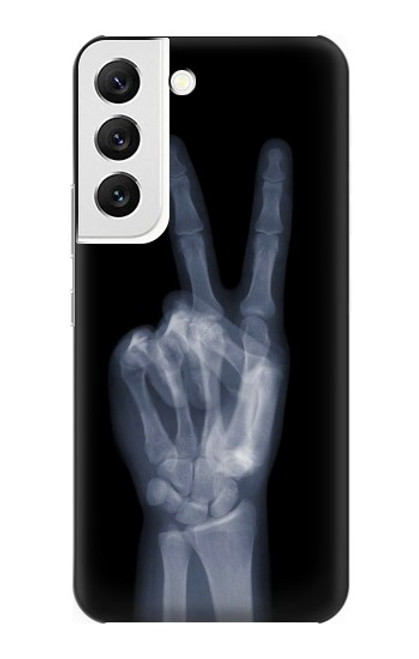 W3101 X-ray Peace Sign Fingers Hard Case and Leather Flip Case For Samsung Galaxy S22