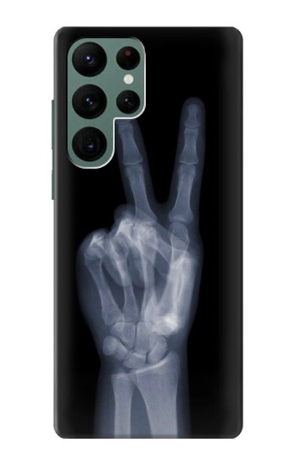 W3101 X-ray Peace Sign Fingers Hard Case and Leather Flip Case For Samsung Galaxy S22 Ultra