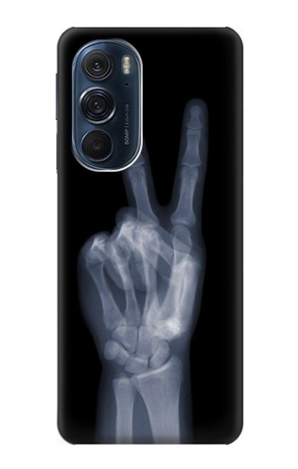 W3101 X-ray Peace Sign Fingers Hard Case and Leather Flip Case For Motorola Edge X30