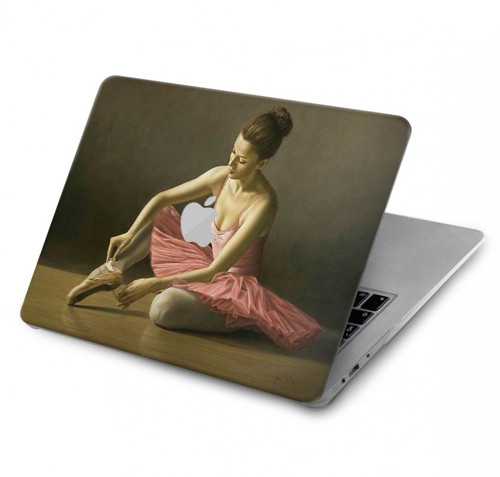 W1241 Ballet Hard Case Cover For MacBook Pro 14 M1,M2,M3 (2021,2023) - A2442, A2779, A2992, A2918