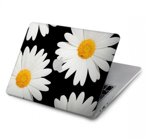 W2477 Daisy flower Hard Case Cover For MacBook Pro 14 M1,M2,M3 (2021,2023) - A2442, A2779, A2992, A2918