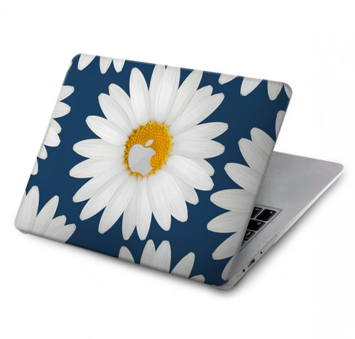 W3009 Daisy Blue Hard Case Cover For MacBook Pro 14 M1,M2,M3 (2021,2023) - A2442, A2779, A2992, A2918