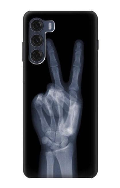 W3101 X-ray Peace Sign Fingers Hard Case and Leather Flip Case For Motorola Moto G200 5G