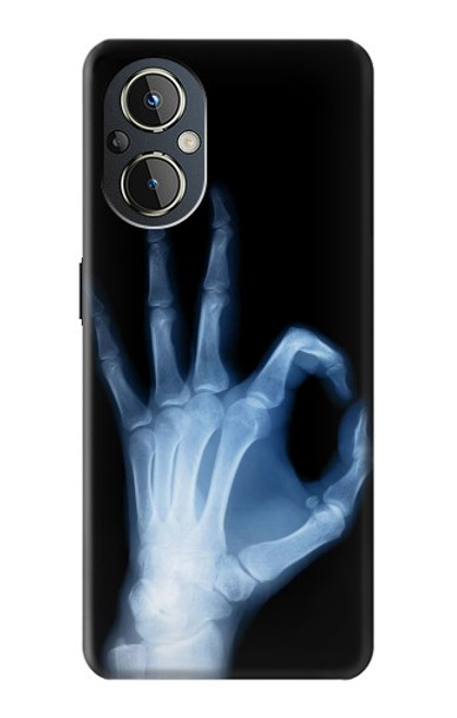 W3239 X-Ray Hand Sign OK Hard Case and Leather Flip Case For OnePlus Nord N20 5G