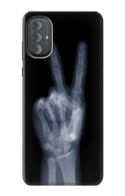 W3101 X-ray Peace Sign Fingers Hard Case and Leather Flip Case For Motorola Moto G Power 2022, G Play 2023